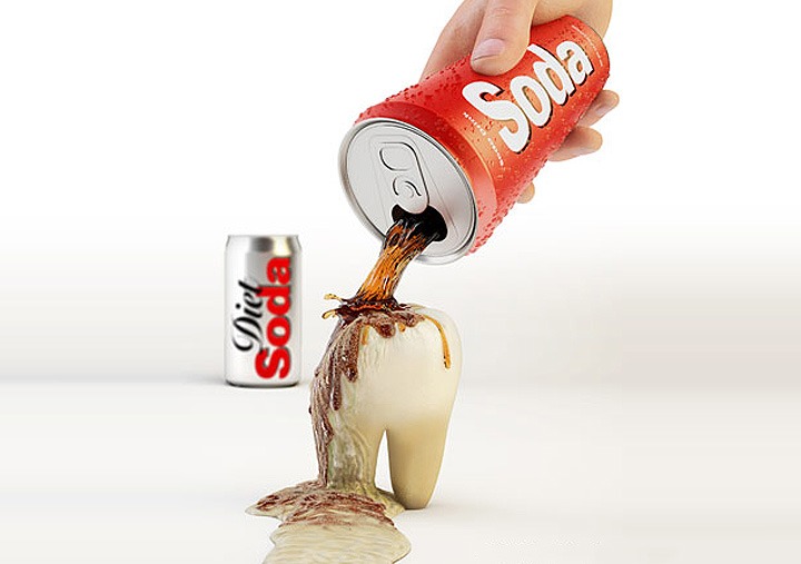 What Does Soda Do to Your Teeth?