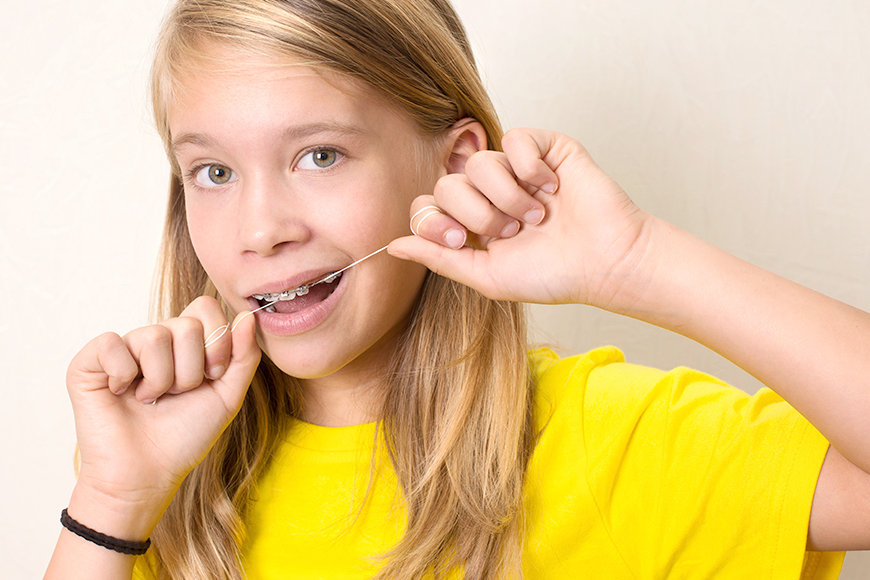 how to use super floss with braces