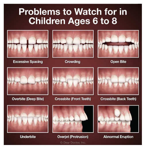 children teeth problems