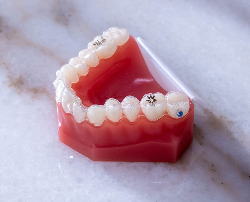 invisalign-product