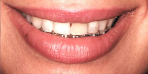 Before Treatment Photo