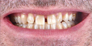 Before Treatment Photo