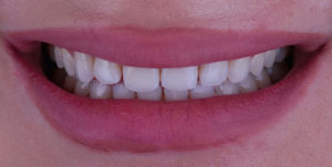 Before Treatment Photo