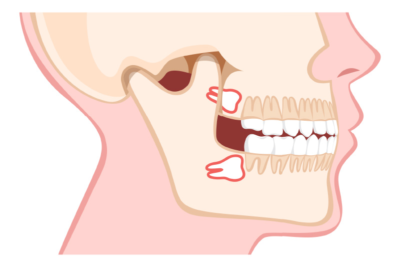 Dubai-Oral-Surgery