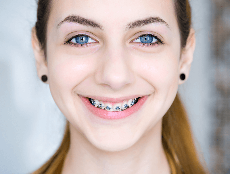 Orthodontics in dubai