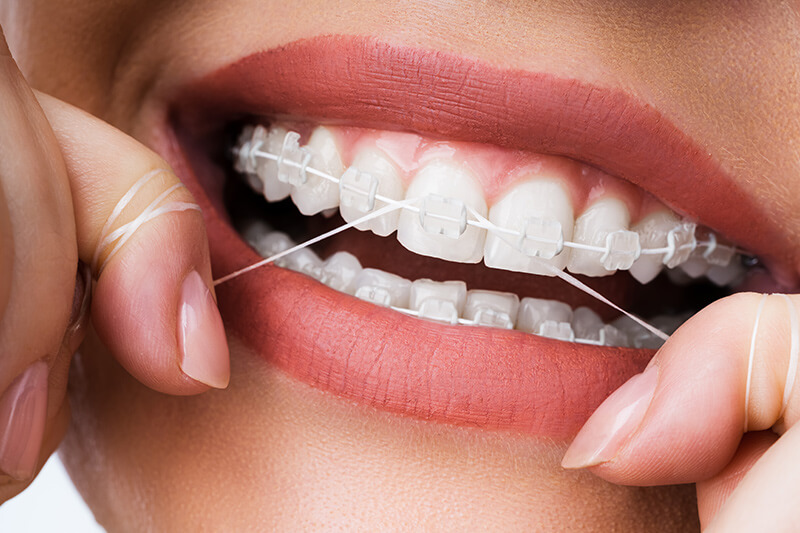 cleaning-teeth-with-flossing