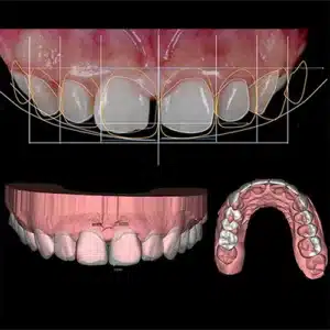 تخطيط DSD