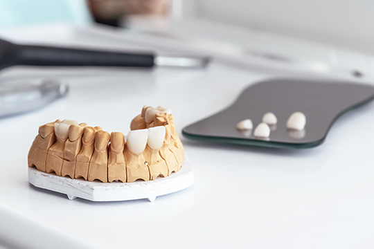 digital smile design in dubai