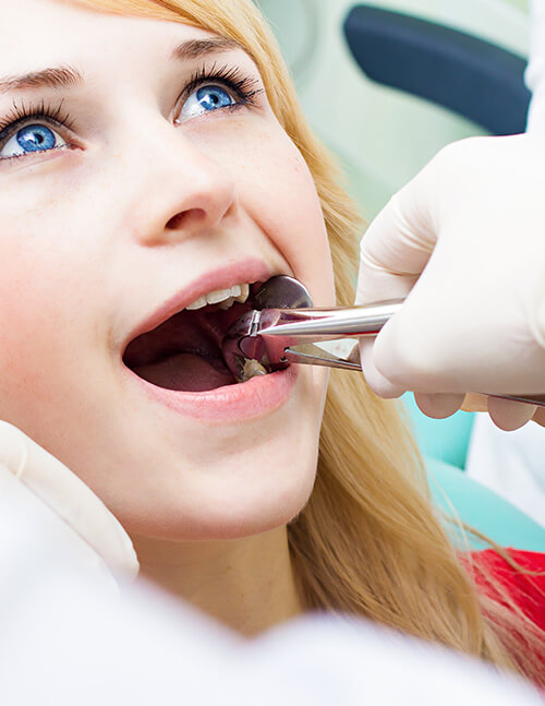 wisdom-tooth-extraction-thumbnail