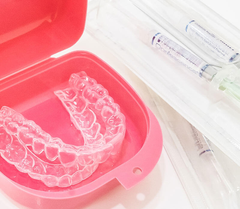 Home-Whitening-Kit-product-photo