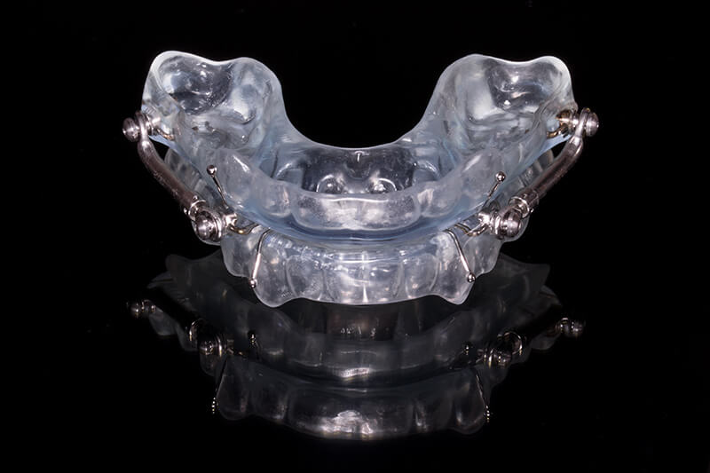 Oral Appliance for Snoring