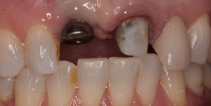 Before Treatment Photo