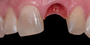 Before Treatment Photo