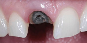 Before Treatment Photo