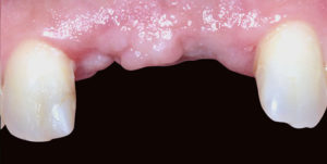 Before Treatment Photo