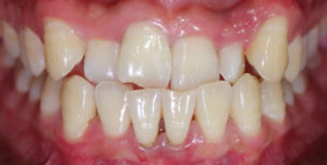 Before Treatment Photo