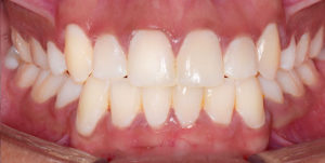 After Treatment Photo