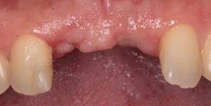 Before Treatment Photo