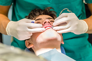 braces men at dental chair