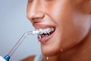 Close-up,Of,A,Smiling,Woman,Face,With,Braces,Cleaning,Her