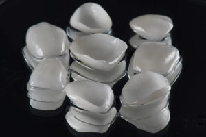 Porcelain laminated dental veneers with mirror black wet background.