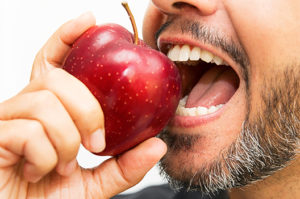 dental implant patient biting apple