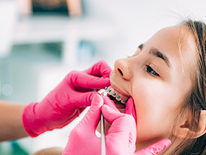 kid-having-braces-adjustments-by-dentist