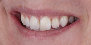 Before Treatment Photo