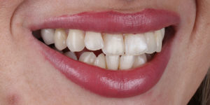 Before Treatment Photo