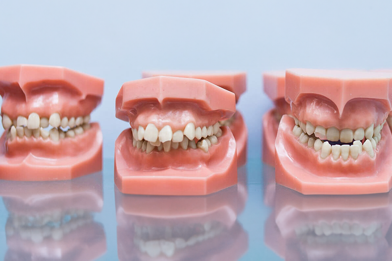 malloclusions