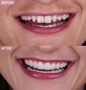 img irregularly tooth