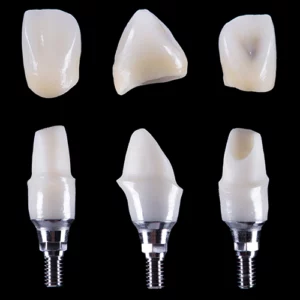 img zirconia implant